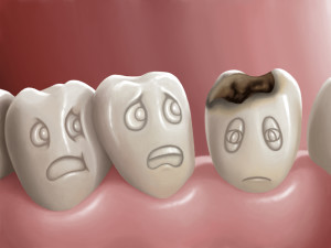 Myths-about-Cavities