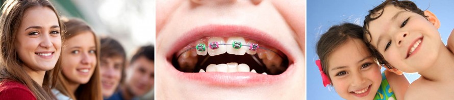 Two Phased Orthodontics Treatment Plan at West Valley Pediatric Dentistry