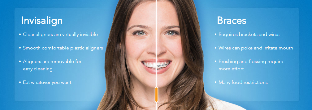 Why People Prefer Invisalign | West Valley Pediatric Dentistry