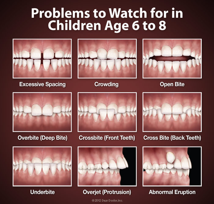 When to see an orthodontist at West Valley Pediatric Dentistry